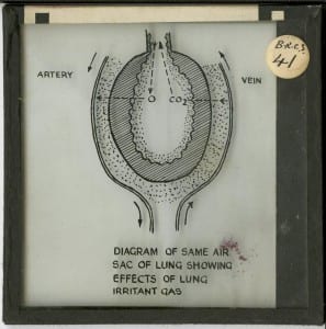 Air sac effect of lung irritants MCR-LS-X.0509. UCL, Ethnography Collections