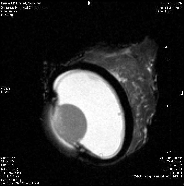 An MRI image of a pig's eyeball