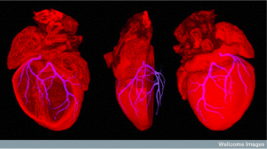 Mouse heart showing position of coronary arteries
