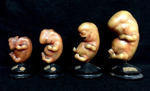 LDUCZ-Z430 Ziegler Studio wax model series showing the development of the external form of human embryos