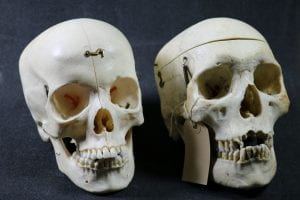 Skulls UCL.16.009 and UCL.16.018