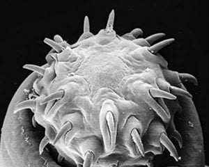 Black and white electron microscope image of the head of a thorny-headed worm showing rows of hooked spines