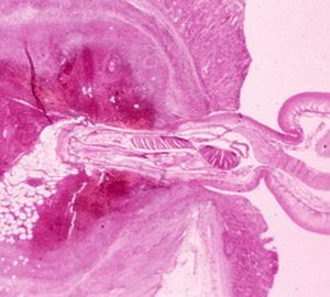 Microscope image of a section through the head of a thorny-headed worm embedded into host tissue. The slide is stained to show the structures in shades of pink.