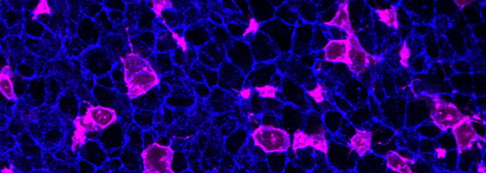 Mutant (magenta) spinal cord cells impair their neighbours' function