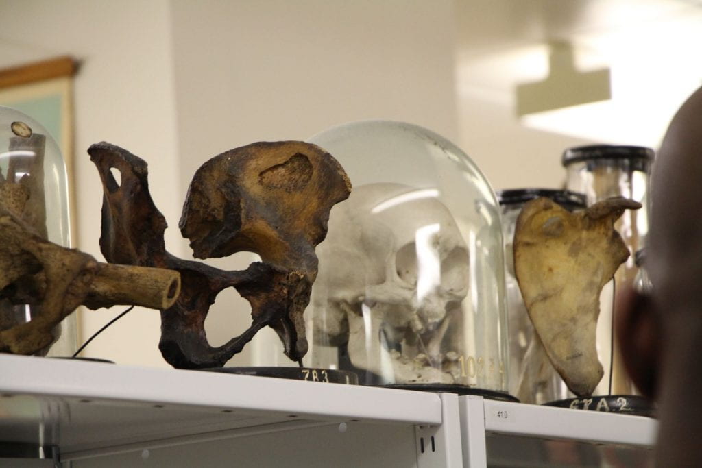 A human skull in a glass Cloche and human bones sections