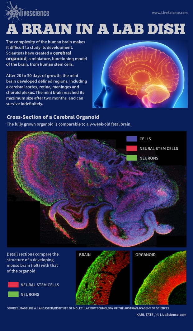 cerebral-organoid-model-brain-130827a-02
